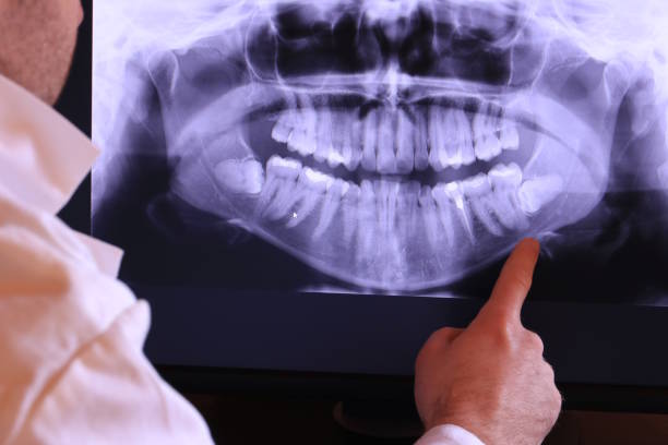 Best Pediatric Emergency Dentist in New Holstein, WI